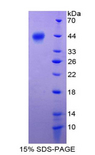 S100A2 Protein - Recombinant S100 Calcium Binding Protein A2 By SDS-PAGE