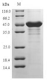 S100A3 / S100E Protein - (Tris-Glycine gel) Discontinuous SDS-PAGE (reduced) with 5% enrichment gel and 15% separation gel.