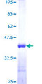 S100A3 / S100E Protein - 12.5% SDS-PAGE Stained with Coomassie Blue.