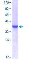 S100A4 / FSP1 Protein - 12.5% SDS-PAGE of human S100A4 stained with Coomassie Blue