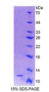 S100A4 / FSP1 Protein - Recombinant S100 Calcium Binding Protein A4 By SDS-PAGE