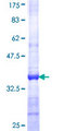 S100A5 Protein - 12.5% SDS-PAGE Stained with Coomassie Blue.