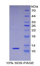 S100A5 Protein - Recombinant S100 Calcium Binding Protein A5 By SDS-PAGE