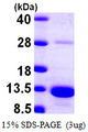 S100A5 Protein