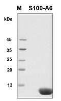 S100A6 / Calcyclin Protein