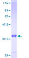S100A6 / Calcyclin Protein - 12.5% SDS-PAGE of human S100A6 stained with Coomassie Blue
