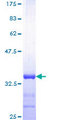 S100A6 / Calcyclin Protein - 12.5% SDS-PAGE Stained with Coomassie Blue.