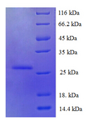 S100A6 / Calcyclin Protein