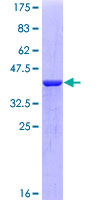 S100A7 / Psoriasin Protein - 12.5% SDS-PAGE of human S100A7 stained with Coomassie Blue