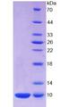 S100A7 / Psoriasin Protein - Recombinant S100 Calcium Binding Protein A7 By SDS-PAGE