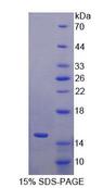 S100A7A / S100A15 Protein - Recombinant S100 Calcium Binding Protein A15 By SDS-PAGE