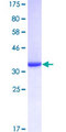 S100A8 / MRP8 Protein - 12.5% SDS-PAGE of human S100A8 stained with Coomassie Blue