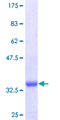S100A8 / MRP8 Protein - 12.5% SDS-PAGE Stained with Coomassie Blue.