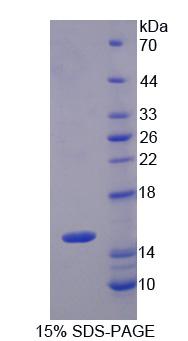 S100A8 / MRP8 Protein - Recombinant S100 Calcium Binding Protein A8 (S100A8) by SDS-PAGE
