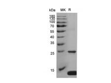 S100A8 / MRP8 Protein - Recombinant Human S100A8 Protein (His Tag)-Elabscience