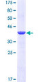S100A9 / MRP14 Protein - 12.5% SDS-PAGE of human S100A9 stained with Coomassie Blue