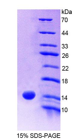 S100A9 / MRP14 Protein - Recombinant S100 Calcium Binding Protein A9 By SDS-PAGE