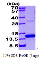 S100A9 / MRP14 Protein