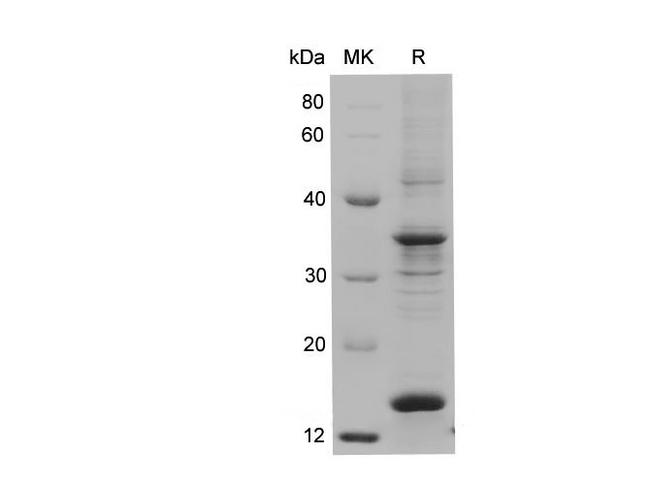 S100A9 / MRP14 Protein - Recombinant Human S100A9 Protein (His Tag)-Elabscience