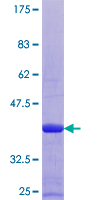 S100B / S100 Beta Protein - 12.5% SDS-PAGE of human S100B stained with Coomassie Blue