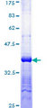 S100B / S100 Beta Protein - 12.5% SDS-PAGE of human S100B stained with Coomassie Blue