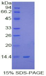 S100B / S100 Beta Protein - Recombinant S100 Calcium Binding Protein B By SDS-PAGE