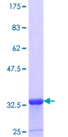 S100P Protein - 12.5% SDS-PAGE Stained with Coomassie Blue.