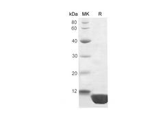 S100P Protein - Recombinant Human Protein S100P protein (His Tag)