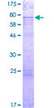 S100PBP Protein - 12.5% SDS-PAGE of human S100PBP stained with Coomassie Blue