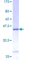 S26 / RPS26 Protein - 12.5% SDS-PAGE of human RPS26 stained with Coomassie Blue