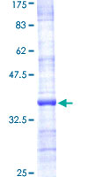 S26 / RPS26 Protein - 12.5% SDS-PAGE Stained with Coomassie Blue.