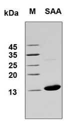 SAA1 / SAA / Serum Amyloid A Protein