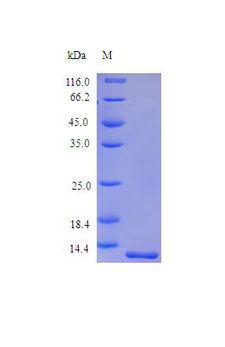 SAA1 / SAA / Serum Amyloid A Protein
