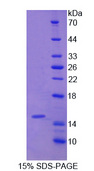 SAA1 / SAA / Serum Amyloid A Protein - Recombinant Serum Amyloid A2 By SDS-PAGE