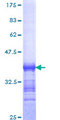 SAA2 / Serum Amyloid A2 Protein - 12.5% SDS-PAGE Stained with Coomassie Blue.