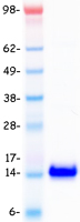 SAA2 / Serum Amyloid A2 Protein - Purified recombinant protein SAA2 was analyzed by SDS-PAGE gel and Coomassie Blue Staining
