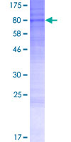 SACM1L / SAC1 Protein - 12.5% SDS-PAGE of human SACM1L stained with Coomassie Blue