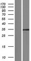 SAE1 Protein - Western validation with an anti-DDK antibody * L: Control HEK293 lysate R: Over-expression lysate