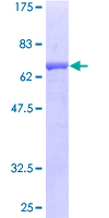 SAE1 Protein - 12.5% SDS-PAGE of human SAE1 stained with Coomassie Blue