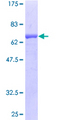 SAE1 Protein - 12.5% SDS-PAGE of human SAE1 stained with Coomassie Blue