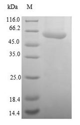 SAE1 Protein - (Tris-Glycine gel) Discontinuous SDS-PAGE (reduced) with 5% enrichment gel and 15% separation gel.