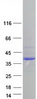 SAE1 Protein - Purified recombinant protein SAE1 was analyzed by SDS-PAGE gel and Coomassie Blue Staining