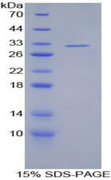 SAG / Arrestin Protein - Recombinant S Antigen By SDS-PAGE