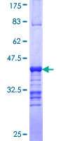 SAGE / SAGE1 Protein - 12.5% SDS-PAGE Stained with Coomassie Blue.