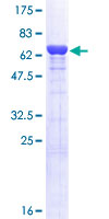 SAHH / AHCY Protein - 12.5% SDS-PAGE of human AHCY stained with Coomassie Blue