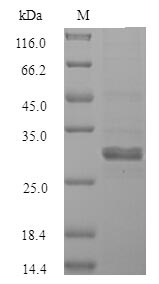 SALL2 Protein - (Tris-Glycine gel) Discontinuous SDS-PAGE (reduced) with 5% enrichment gel and 15% separation gel.