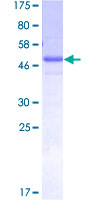 SALL2 Protein - 12.5% SDS-PAGE of human SALL2 stained with Coomassie Blue