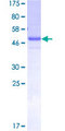 SALL2 Protein - 12.5% SDS-PAGE of human SALL2 stained with Coomassie Blue