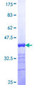 SALL4 Protein - 12.5% SDS-PAGE Stained with Coomassie Blue.