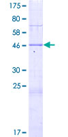 SAMD10 Protein - 12.5% SDS-PAGE of human SAMD10 stained with Coomassie Blue